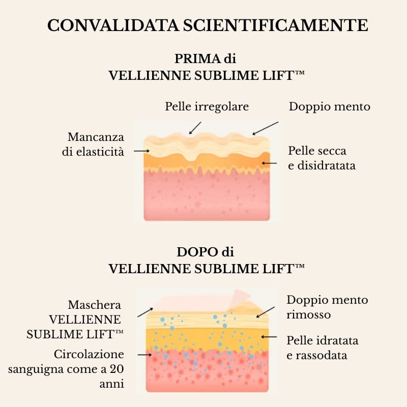 VELLIENNE SUBLIME LIFT™