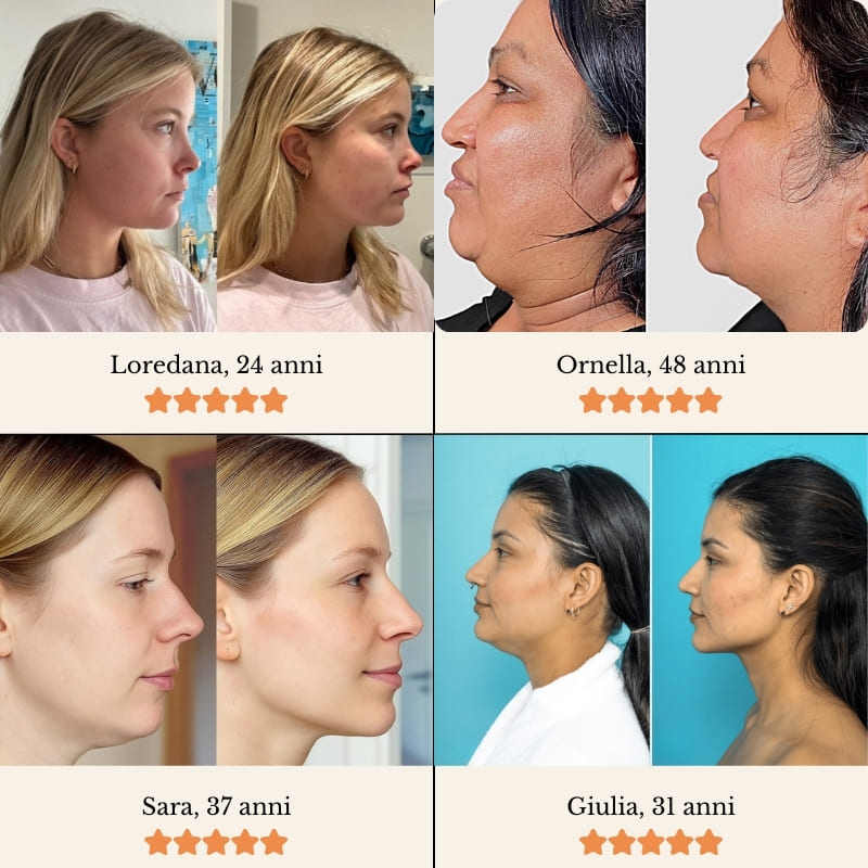 VELLIENNE SUBLIME LIFT™